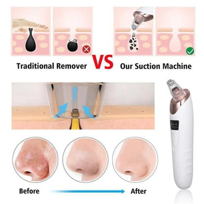 BLACKHEAD REMOVING TOOL